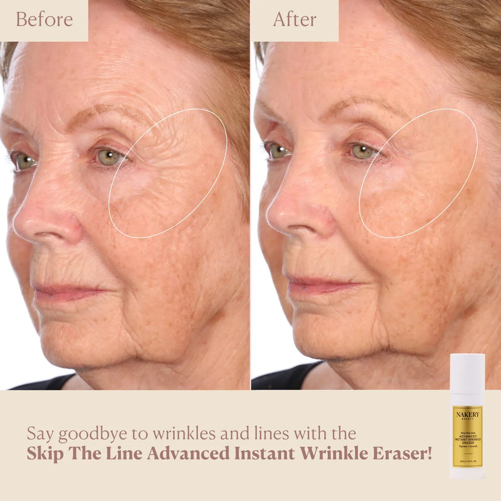Nakery Skip the Line Advanced Instant Wrinkle Eraser